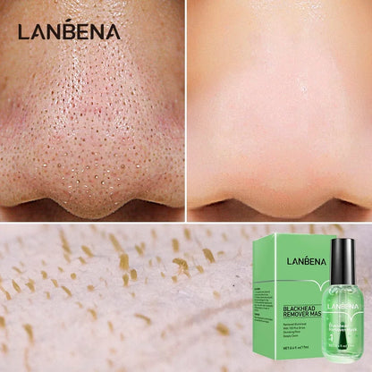LANBENA Blackhead Remover Mask